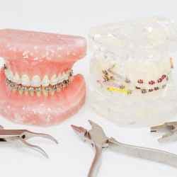 Orthodontics Comparison